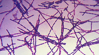 A UK Government Lab Accidentally Mailed Out Live Anthrax